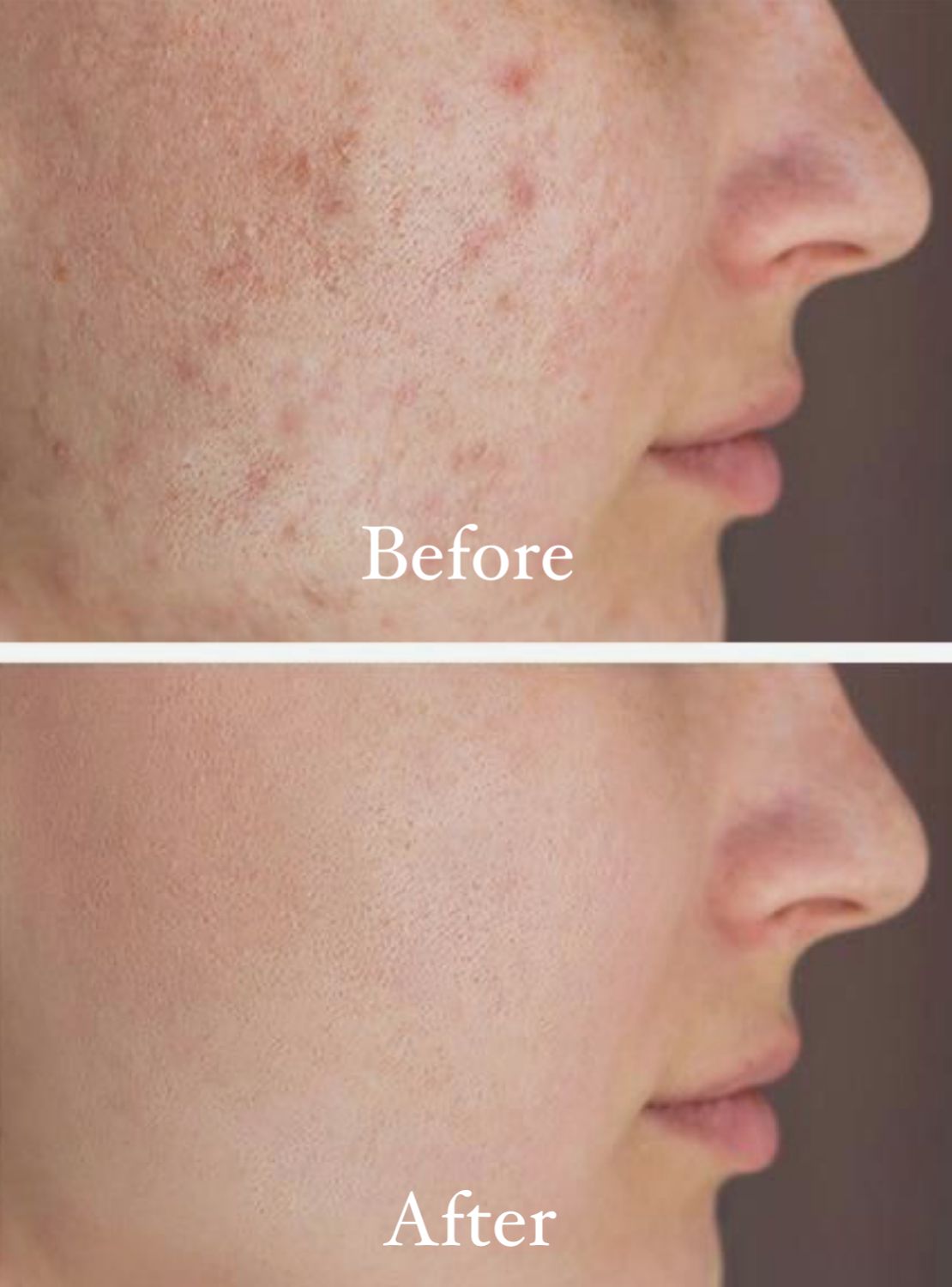 SEAWEED GEL FACEWASH - 3.4 FL OZ / 100 ML